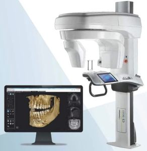The Benefits of Cone Beam Machine for Wisdom Teeth and Implants | Karalee Family Dental